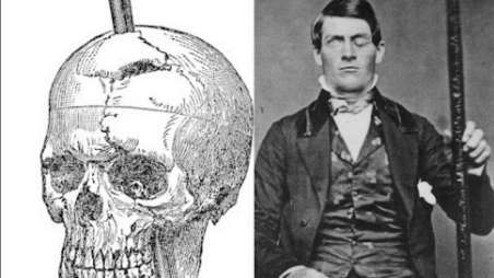 Phineas Gage